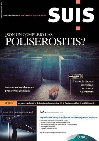 ¿Son un complejo las poliserositis? - Suis - N°124, Ene-Feb. 2016