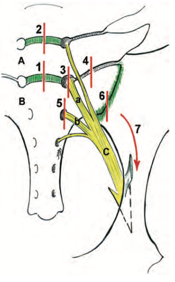 Fig. 1. Schematic drawing by Denoix of the ventral aspect of the lumbosacral region