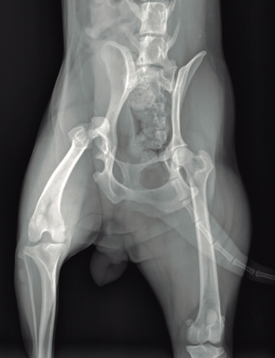 Figura 1. Radiografía prequirúrgica en la que se observa la luxación completa.