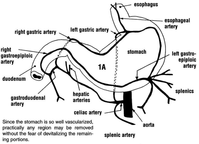 Figure 19-1. Pertinent gastric arterial anatomy