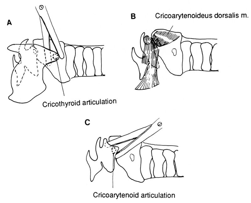 The cricothryroid articulation at the caudal edge of the thyroid cartilage is separated with scissors and/or a Freer septum elevator