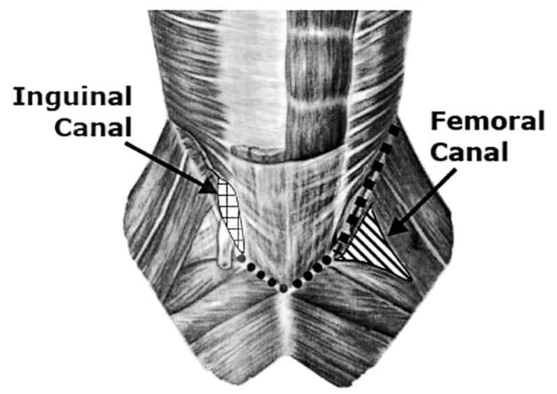 Figure 38-25. Caudoventral abdominal wall and inguinal anatomy