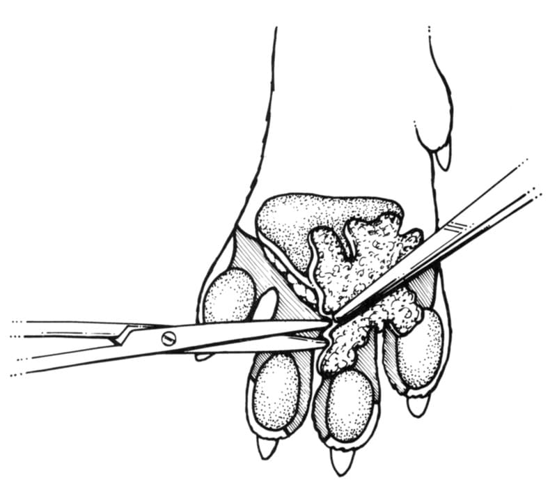 Figure 41-56. Fusion podoplasty