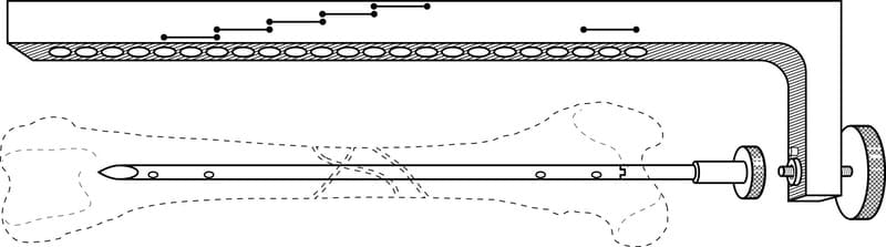 Figure 50-4. The drill aiming guide is attached to the end of the nail