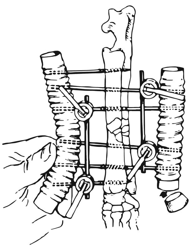 Figure 53-13. C. Sidebar tubes are applied to the cut ends of the fixation pins