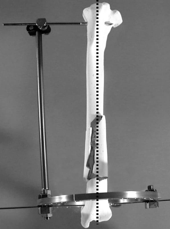 Figure 53-72. B. Once alignment is achieved, the SK clamp is re-tightened