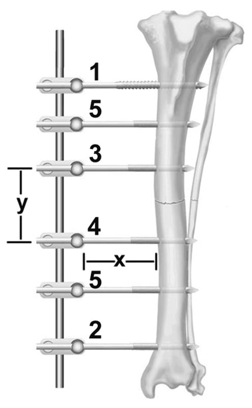 Figure 53-9. Fixation pin and frame working lengths and the order of pin placement