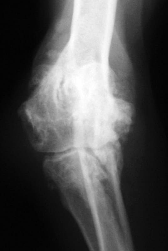 Photograph (left) of a dog with lameness and elbow pain in the right elbow