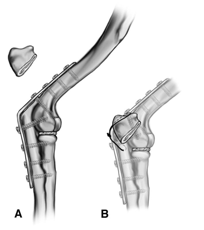 Radiographs taken immediately after surgery of the case presented in Figure 56-41.