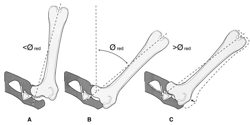 Hip reduction by abduction begins (less than Øred) with the femoral head resting and stable in the dorsal joint capsule