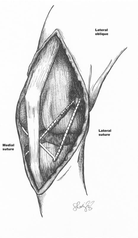 Figure 61-31. Lateral oblique of the left stifle