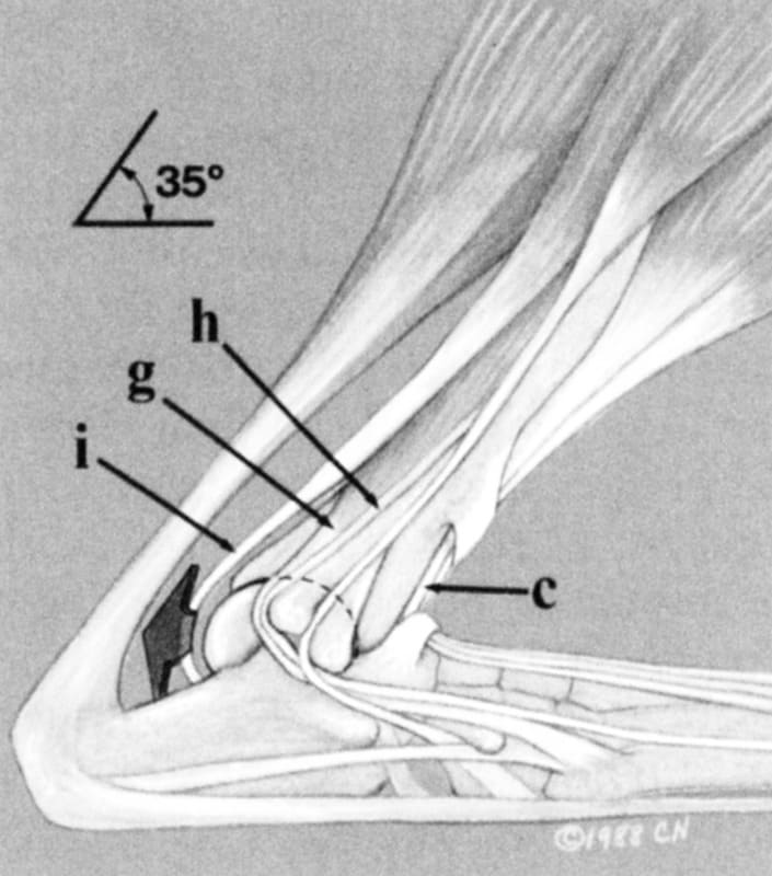Figure 62-40. Plantarolateral approach to the hock