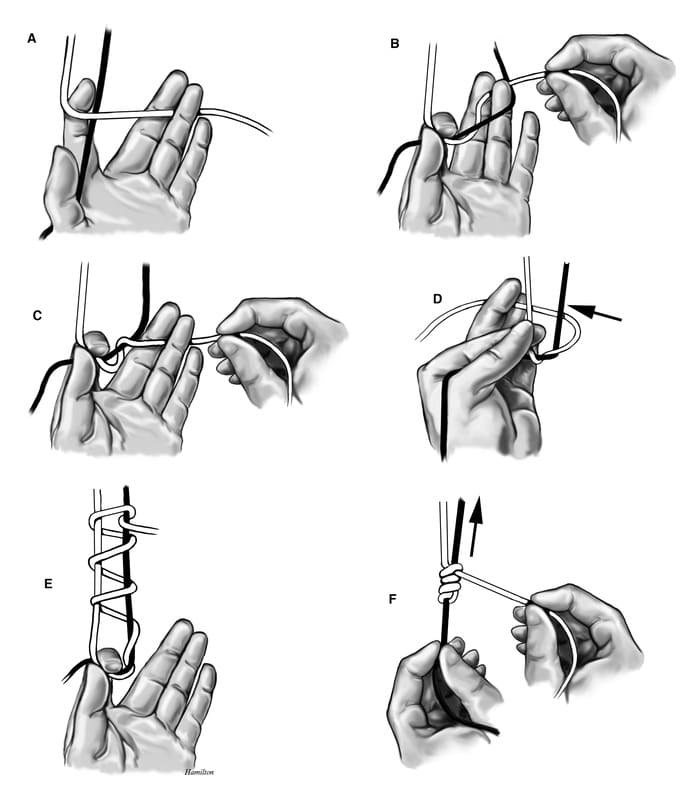 Figure 7-1. Extracorporeal Knot Tying