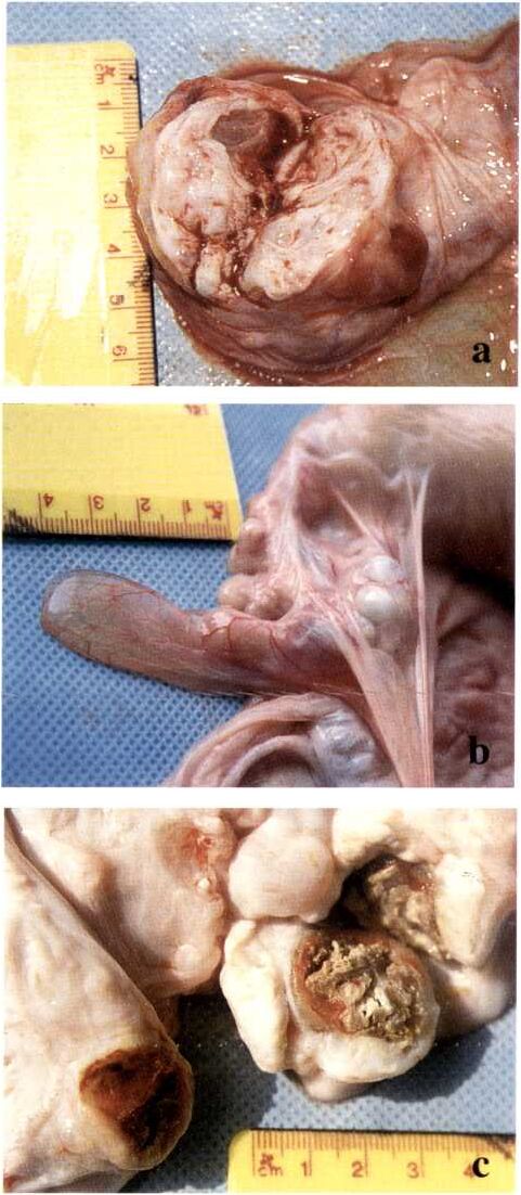 Figure 8.7 (a-i): Ovarian pathology