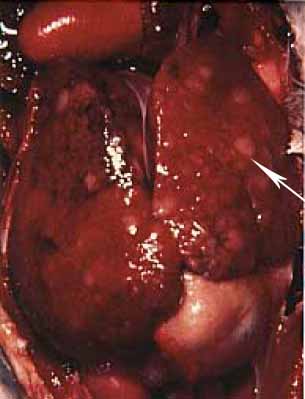 Raised, white nodules in the liver at necropsy along with an accumulation of lymphoid cells in the nodules consistent with lymphosarcoma 