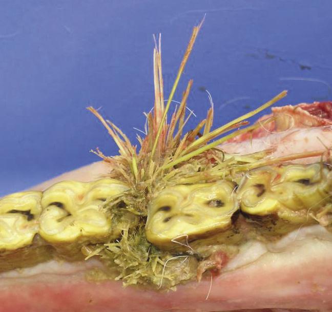 Extensive food stasis within a diastemata.